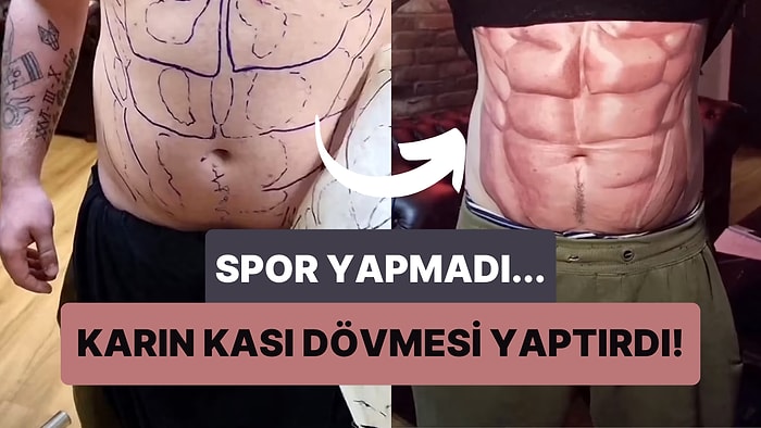 Tatile Gitmeden Önce Göbeğini Gizlemek İçin Spor Yapmak Yerine Karın Kası Dövmesi Yaptıran Adam