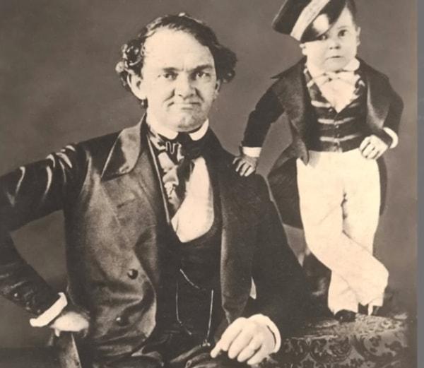1. Minyatür Adam Charles Stratton -Sahne Adı ile 'General Tom Thumb'