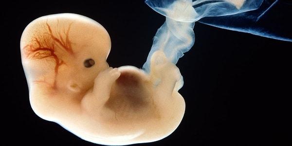 Ancak fetüs içinde fetüs vakaları son derece nadirdir.