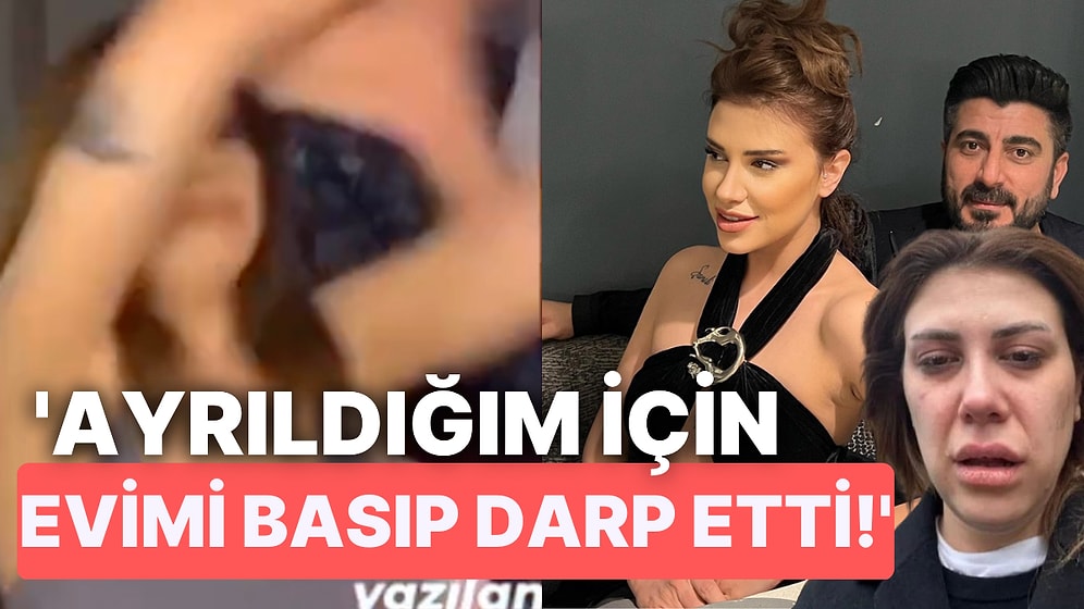 Canlı Yayında Şiddet Gören Kısmetse Olur Melis, Sevgilisinin Evi Basarak Kendisini Darp Ettiğini İddia Etti!