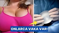 Uzmanlar Uyardı: Meme İmplantları Cilt Kanserine Sebep Oluyor!