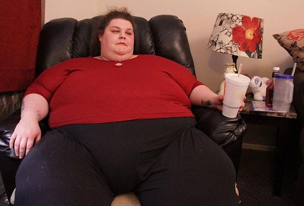 3. Aşırı yağlanma ve obezite görülebilir.