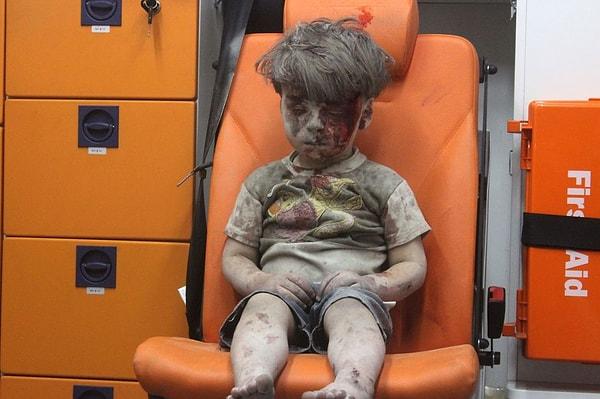 14. Suriye'nin Halep kentinde düzenlenen hava saldırısının ardından yaralanan 5 yaşındaki Ümran Dakniş.