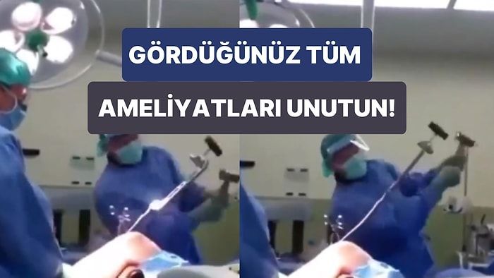 Tamir Yapar Gibi Bacağına Çekiçle Vurularak Yapılan Ortopedi Ameliyatının Şaşkına Çeviren Görüntüleri