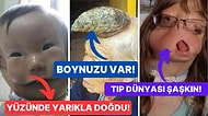 Daha Önce Hiçbir Yerde Duymadığınızı İddia Ettiğimiz Tıp Dünyasını Bile Şaşkına Çeviren 15 Hastalık