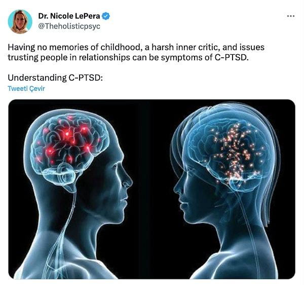 "Çocukluk, beyin ve sinir sistemi gelişiminin en kritik dönemidir" diyen  Dr. Nicole LePera karmaşık travma sonrası stres bozukluğunun çocukluktan gelebileceğini söylüyor.