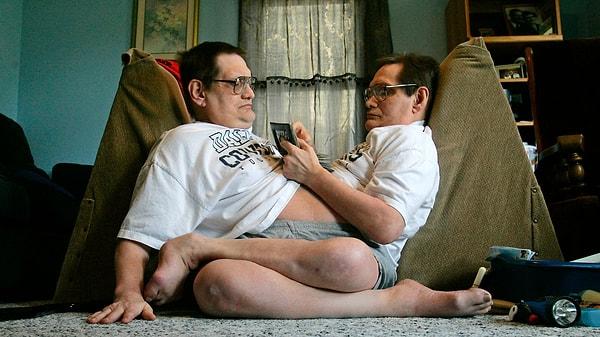 13. Donnie ve Ronnie Galyon, 2014 yılında 63 yaşındayken dünyanın en uzun yaşayan yapışık ikizleri olarak  Guinness Rekorlar Kitabı'na girdiler.
