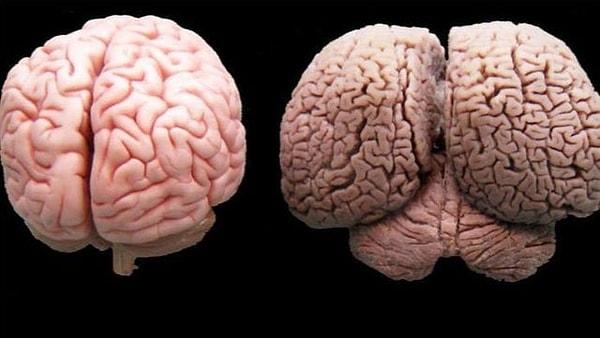 2. İnsan beyni vs. yunus beyni
