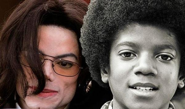 2009 yılında hayatını kaybetmesiyle hayranlarını yasa boğan Michael Jackson, yaşadığı süre boyunca da gerçek anlamda ilginç bir hastalığa sahipti.