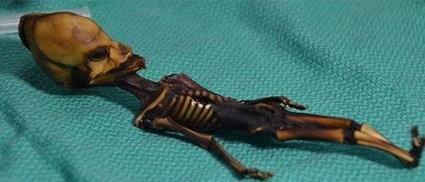 Ata'nın küçüklüğü ve 6 yaşındaki bir çocuğunki kadar gelişmiş kemiklere sahip olması uzmanları da şaşırttı.