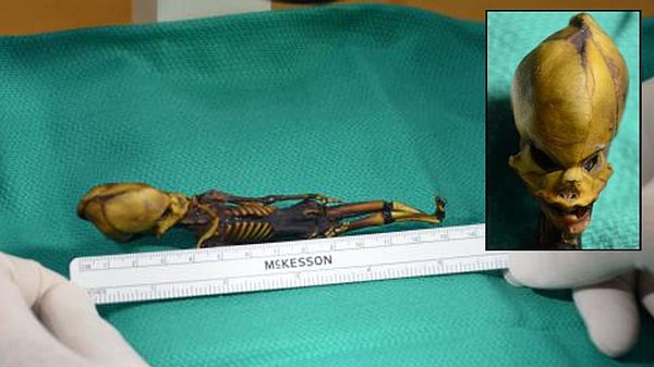 "Деформации было настолько сильными, что ее невозможно было прокормить", - объяснил Нолан.