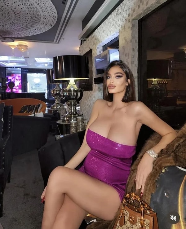 5. Отсутствие верных пропорций тела этой девушке явно не к лицу 😳