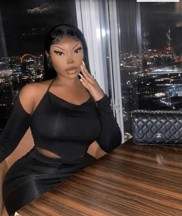 13. Жертва пластики? А нет, фотошопа...