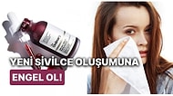 Yorumlarıyla Gönülleri Mest Etmiş Sivilce Karşıtı En İyi 21 Ürün