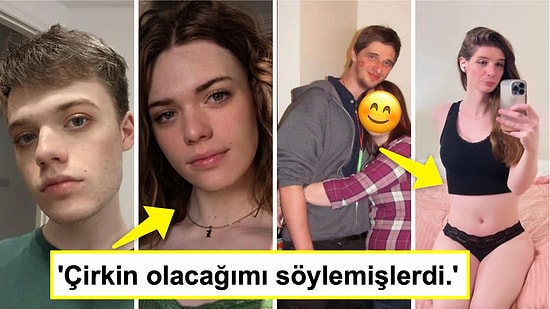 Cinsiyet Geçiş Ameliyatları Sonrası Hayal Ettikleri Bedene Kavuşan İnsanların Değişimi