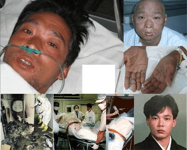 10. "Hisashi Ouchi 83 gün boyunca radyasyona maruz bırakılan 'denek'lerden biridir."