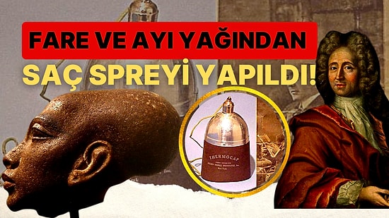 'Kel Kalsam Daha İyiydi' Diyeceğiniz Tarih Boyunca Uygulanmış Birbirinden Acayip Kellik Tedavileri