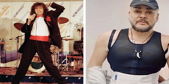 8 звездных мужчин, которые изменили свою внешность пластикой и инъекциями