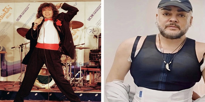 8 звездных мужчин, которые изменили свою внешность пластикой и инъекциями