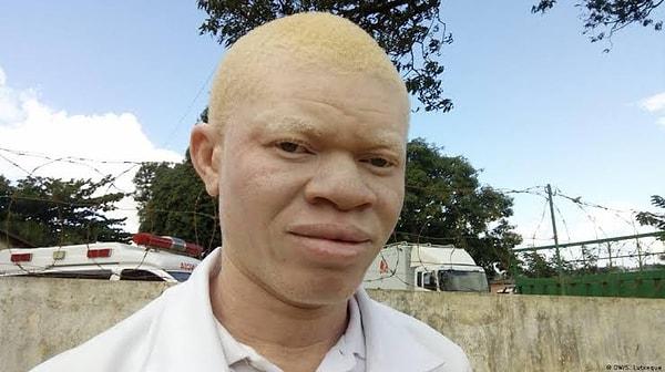 Yaklaşık 10 ay önce yani 2022 yılının Mayıs ayında yine Mozambik’te genç bir albino adam, amcası tarafından ülkenin Mogovolas bölgesinde para ayini için öldürüldü. Suçu itiraf eden amca polise, kurbanın vücut parçaları için kendisine yaklaşık 110 bin dolar vaat edildiğini söyledi.