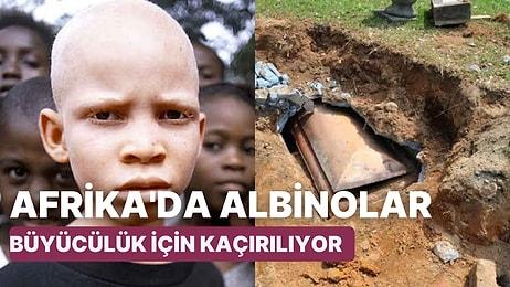 Mozambik'te Mezarı Betonla Korunan Albino Bir Adamın Cesedi Büyü İşlerinde Kullanılmak İçin Çalındı