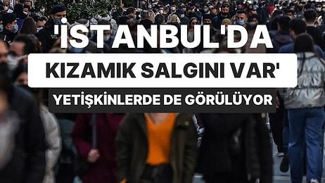 İstanbul İçin Salgın Uyarısı: ‘Kızamık Yetişkinlerde de Görülmeye Başlandı’