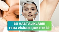 Daha Genç Bir Görünüm İçin Tercih Edilen Botoksun Tedavi Olarak Kullanıldığı Hastalıklar