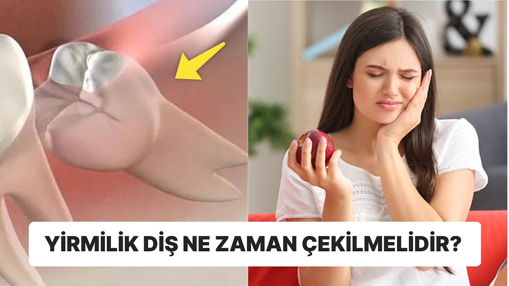 Ağrısıyla Uykusuz Gecelere Sebep Olan Yirmilik Diş Hakkında Bilmeniz Gerekenleri Açıklıyoruz