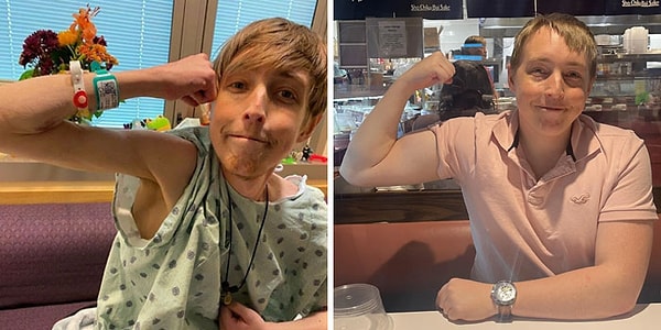 6. «Два года назад сегодня я пережил чрезвычайно рискованную операцию, которая, как думали врачи, убьет меня. Я весил 42 кг, сегодня я вешу 82 кг»