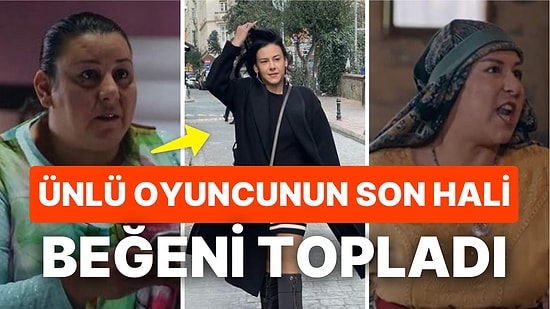 Esin Gündoğdu Son Haliyle Takdir Topladı: Esin Gündoğdu Nasıl Kilo Verdi, Kimdir?