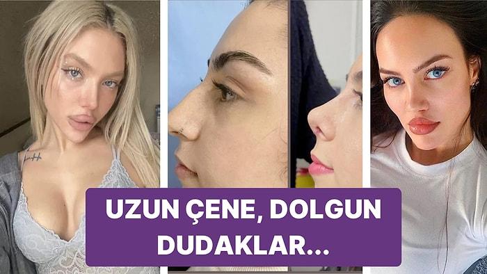 Globalleşen Dünyaya Rağmen Hâlâ Her Ülkeye Göre Değişiyor: Türkiye Güzellik Standartlarında Son Durum Ne?