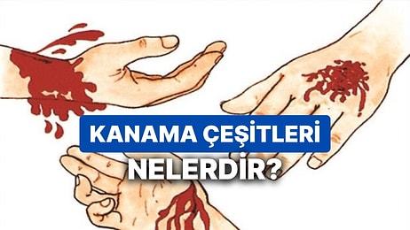 En Ciddi ve Kısa Sürede Kan Kaybına Neden Olan Kanama Çeşidi Hangisidir? Atardamar Kanaması Özellikleri Neler?