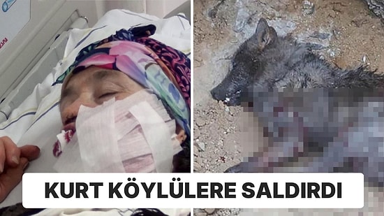 Erzurum'da Kurt Saldırısı: 4 Kişi Yaralandı, 1’nin Durumu Ağır