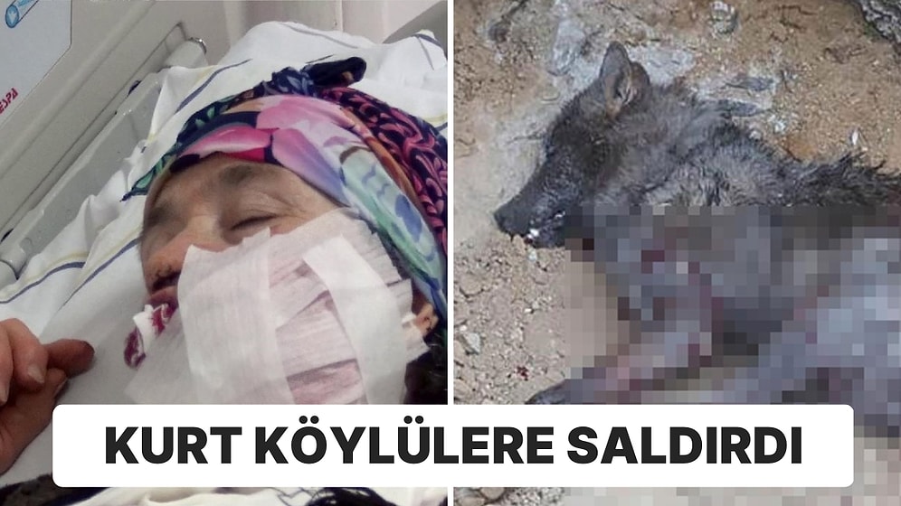 Erzurum'da Kurt Saldırısı: 4 Kişi Yaralandı, 1’nin Durumu Ağır