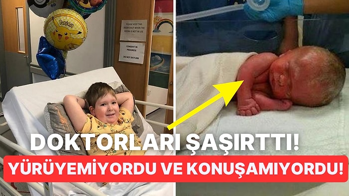 Tıp Dünyası Şaşkın: Çok Nadir Görülen Bir Anomaliyle Dünyaya Gelen Çocuk Tam Anlamıyla 'Beyinsiz' Doğdu!