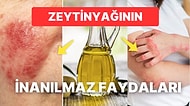 Aknelerin Yok Olmasından Gözeneklerin Sıkışlaşmasına Zeytinyağının Cilde Olan İnanılmaz Faydaları