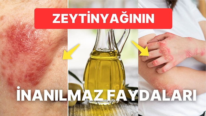 Aknelerin Yok Olmasından Gözeneklerin Sıkışlaşmasına Zeytinyağının Cilde Olan İnanılmaz Faydaları