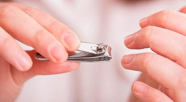 10. "Kocamın tırnak makası kullanmadığını evlenince fark etmiştim. Tırnaklarını ısırarak koparıyor."