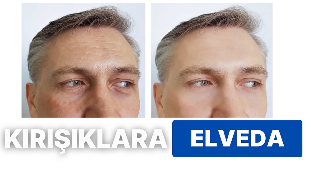 Kırışıklık Giderici Kremden Göz Çevresi Bakımına! En İyi Erkek Anti-Aging Ürünleri