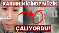 Karnından Müzik Sesi Geldiğini Fark Edince Anladı: Çinli Fenomen Uykusunda Kulaklığını Yuttu!