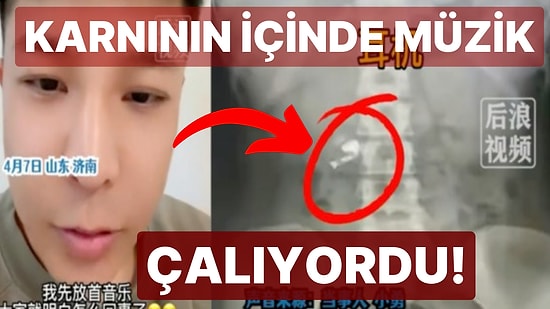 Karnından Müzik Sesi Geldiğini Fark Edince Anladı: Çinli Fenomen Uykusunda Kulaklığını Yuttu!