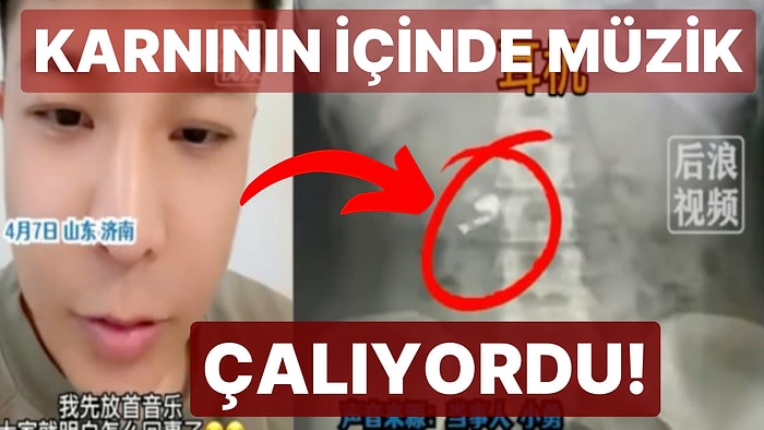 Karnından Müzik Sesi Geldiğini Fark Edince Anladı: Çinli Fenomen Uykusunda Kulaklığını Yuttu!