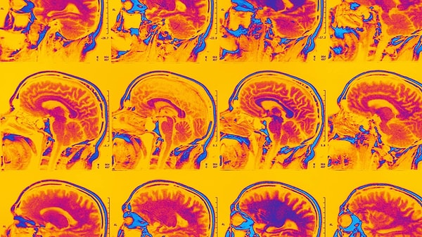 Хотя наблюдаемые результаты не могут быть признаны достоверными, то следует отметить, что за многие годы не было зарегистрировано ни одного случая диагностики шизофрении у пациентов с врожденным нарушением зрения. Это является весьма замечательным фактом.