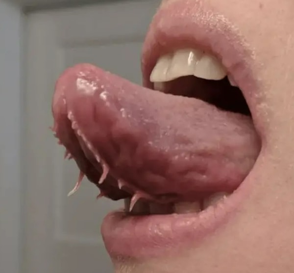 18. Бахромчатые складки — не ранят и не вредят человеку, но выглядят очень страшно