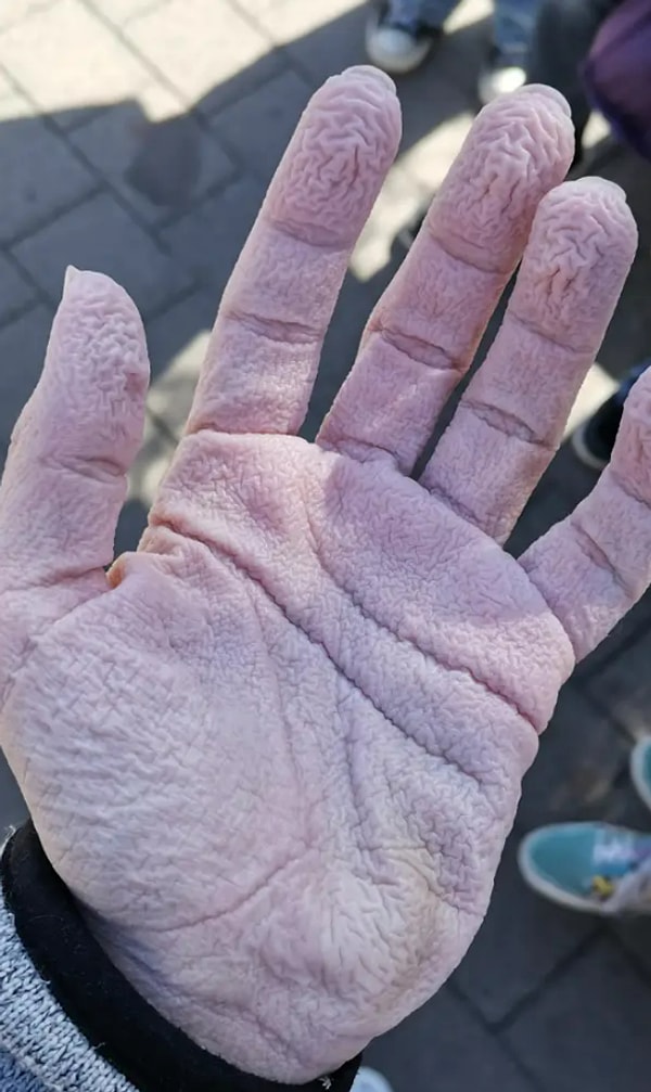 19. «Моя рука после плавания сегодня»