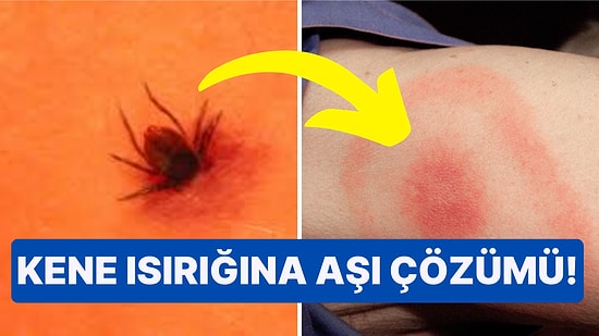 Yaza Girerken Dikkat! Kene Isırığı ile Bulaşan Lyme Hastalığı'nın Aşısı Çok Yakında Çıkacak!
