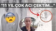 11 Yıl Boyunca İçinde Unutulan İğne ve İplikle Yaşayan Kadının Okuyanı Dehşete Düşüren Hikayesi!