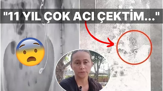 11 Yıl Boyunca İçinde Unutulan İğne ve İplikle Yaşayan Kadının Okuyanı Dehşete Düşüren Hikayesi!