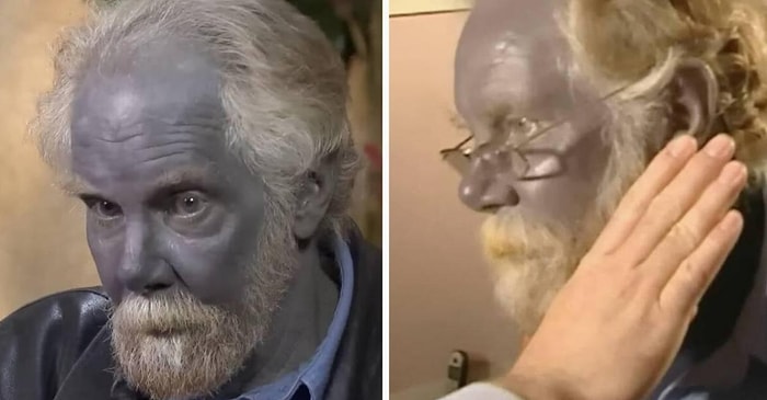 Мужчина по прозвищу «Папа Смурф» принимал серебро до самой смерти, чтобы оставаться синим