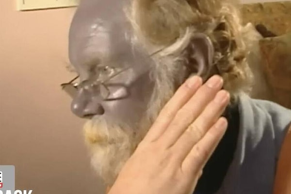 Но выяснилось, что смесь обладает необычным побочным эффектом